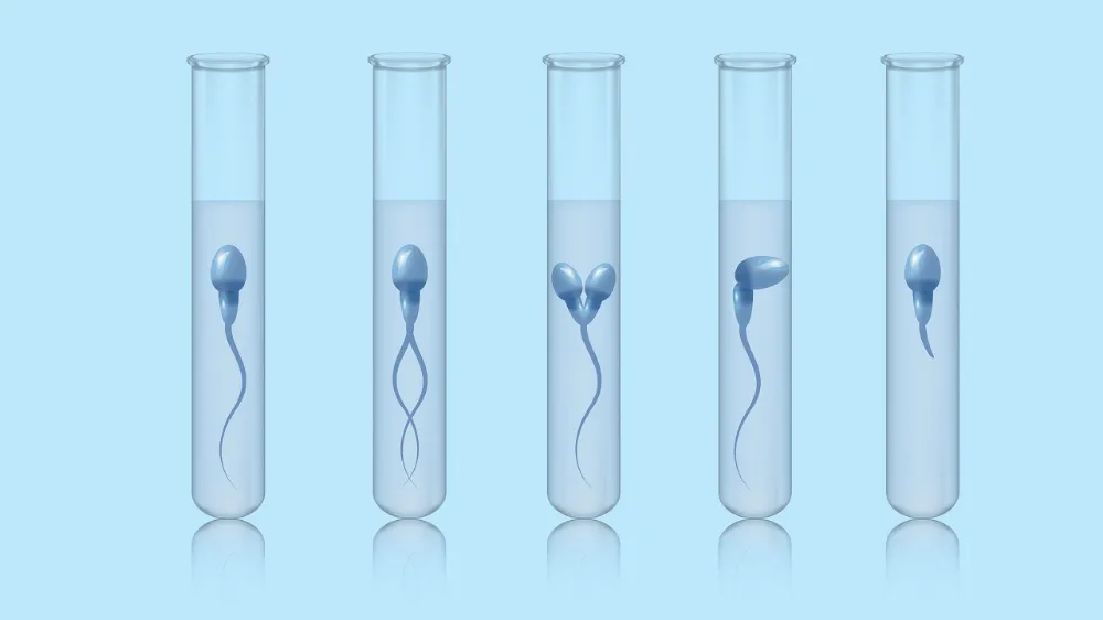 Sperm Testi Tanımı ve Yapılma Nedeni